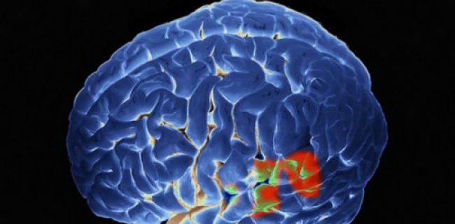 BrainSpeeder : Entraînez votre cerveau